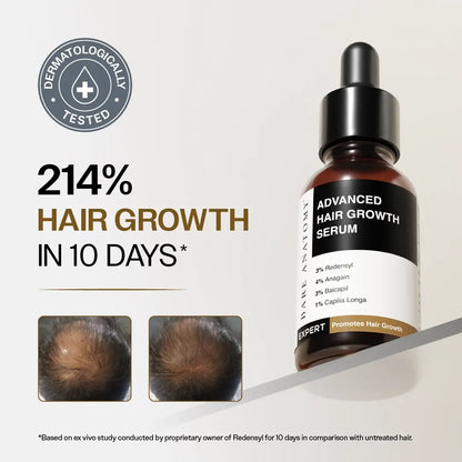 Hair Growth Serum (30 ml) &amp; Anti-Dandruff Shampoo (250 ml) Combo