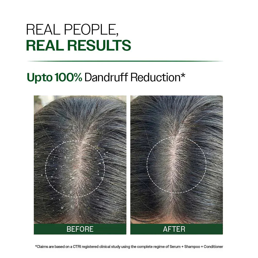 Anti Dandruff Shampoo with Salicylic Acid, Piroctone Olamine &amp; Biotin - 250ml