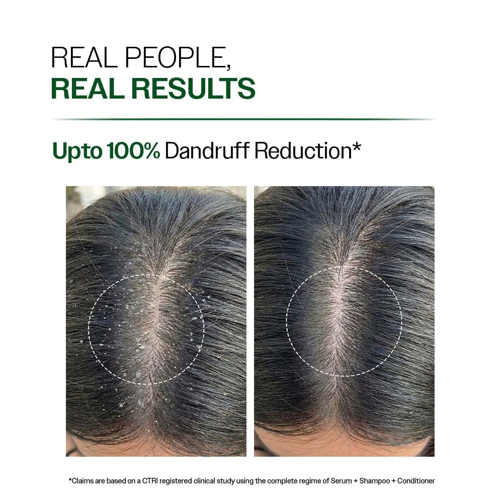 Anti Dandruff Shampoo with Salicylic Acid, Piroctone Olamine &amp; Biotin - 250ml Pack-3